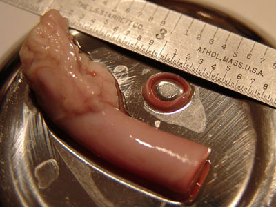 Pig Artery Ring Section